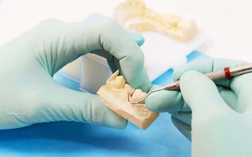 Precio de una reconstrucción La incrustación restaura los dientes