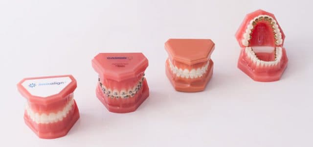 precio de ponerse brackets en ecuador