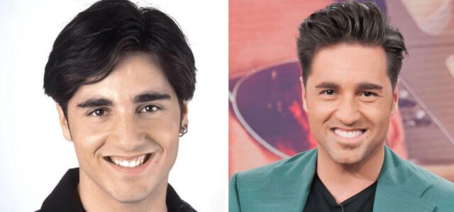 David Bustamante con carillas dentales