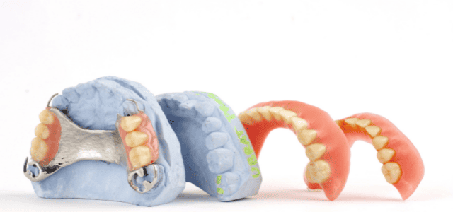 Las dentaduras postizas o los dientes postizos realizados sobre la