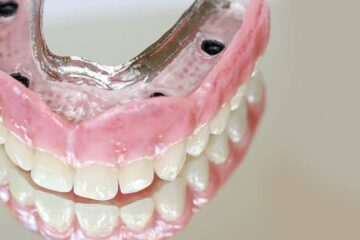 dentadura postiza completa