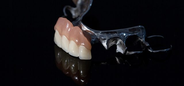 Las prótesis dentales desgastan los dientes