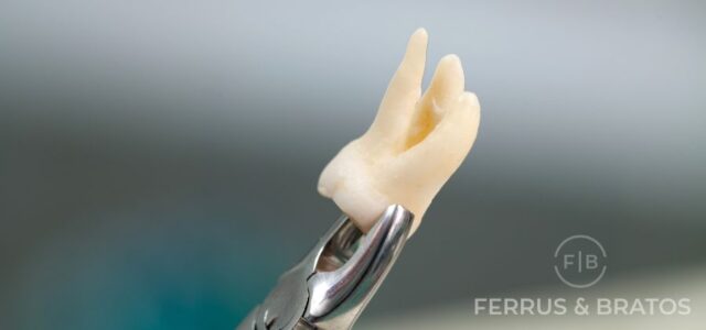 Avulsión dental tratamiento