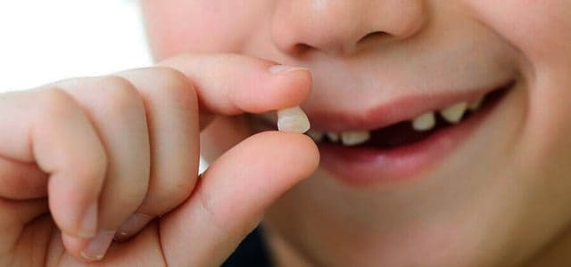 Dentición mixta