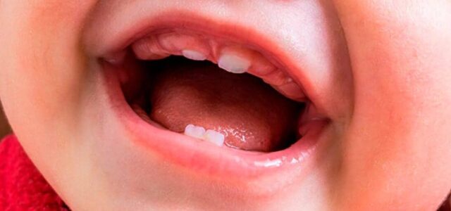 Dentición en bebés Dientes bebés