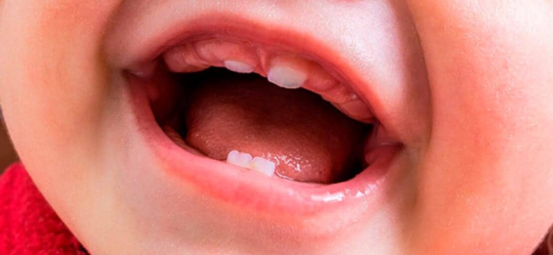 Dientes del bebé ¿Hay que limpiar ya el primer diente del bebé