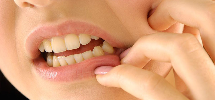 Anestesia casera para dientes