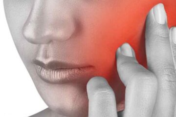 Dolor orofacial qué es