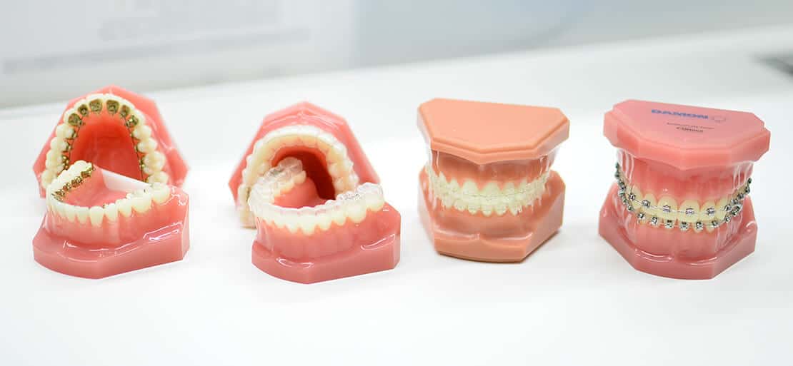 cuanto+cuesta+un+implante+dental+en+uruguay