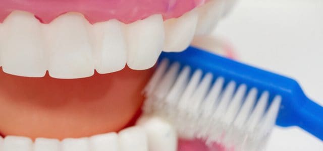 Profilaxis dental