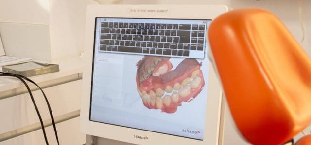 Escáner intraoral 3D