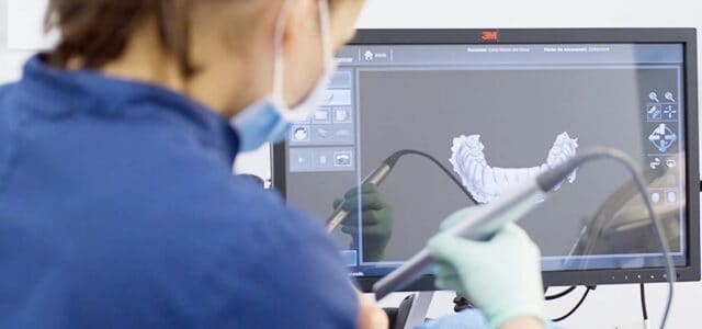 Escáner intraoral en 3D de Odontología