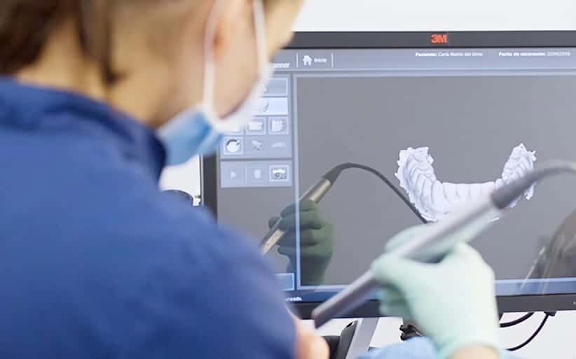 Escáner intraoral en 3D de Odontología