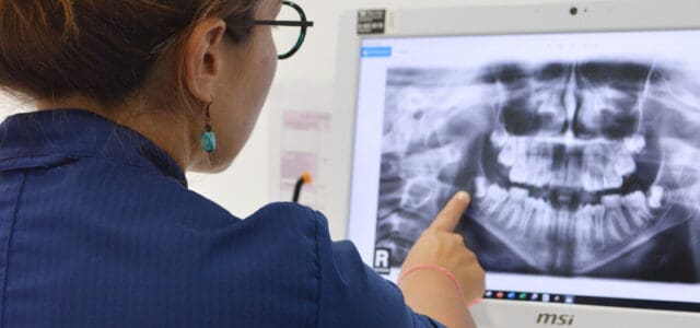 También llamada ortopantomografía
