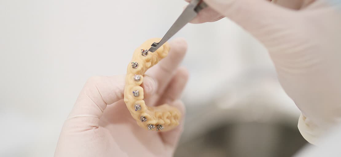 Comparativa Precios Brackets 2024 Ferrus&Bratos