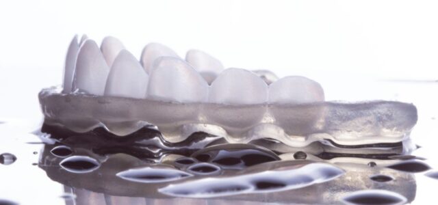 Aparece un diseño de sonrisa como parte del proceso de colocación de las carillas dentales