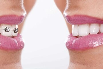 Fases de la ortodoncia