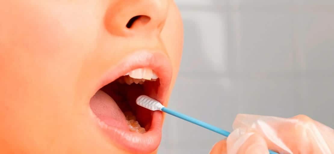 Nombres de los dientes ¿cómo se llama cada uno? Ferrus&Bratos