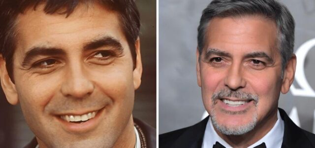 George Clooney con carillas dentales