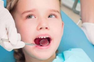 Gingivitis en los niños