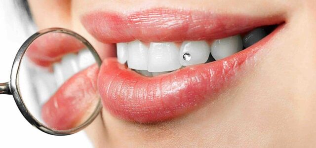Joyas en los dientes Brillantes en los dientes