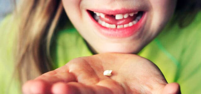 Dentición mixta