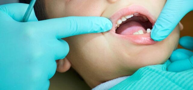 Halitosis: cómo acabar con el mal aliento de los niños