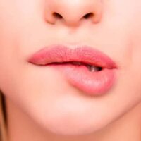 Herpes labial qué es