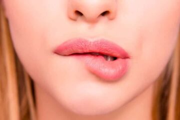 Herpes labial qué es