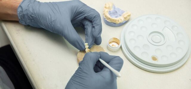 lo que no te cuentan de los implantes dentales Aparece un protésico trabajando.