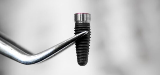 De qué material son los implantes dentales y cómo se fabrican Dentista sosteniendo un implante dental de titanio con corona cerámica, ejemplificando de qué material son los implantes dentales modernos.