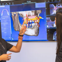 planificacion de implantes dentales con poco hueso
