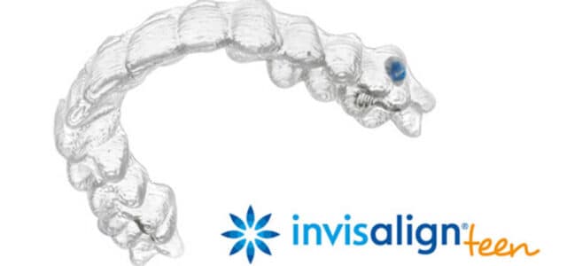 Invisalign Teen