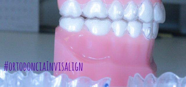invisalign dientes sistema limpieza invisalign