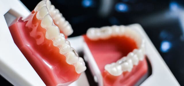 Alineadores de Invisalign Lite
