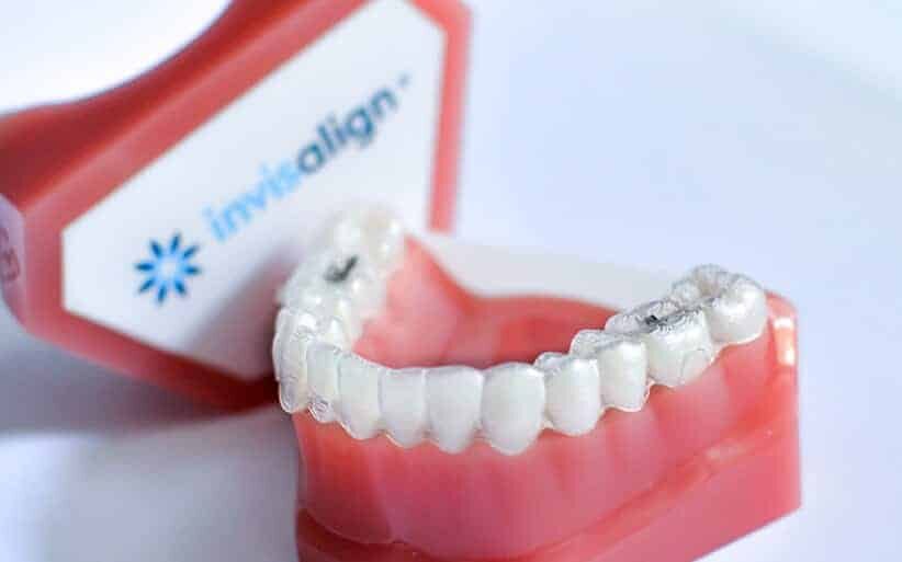 Invisalign Lite cuánto cuesta