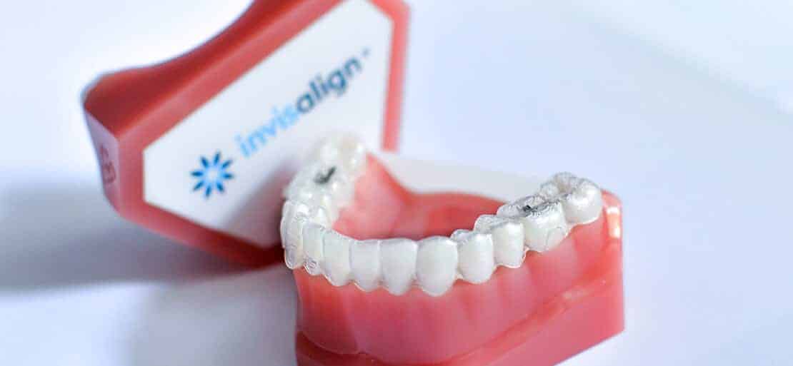 Invisalign Lite cuánto cuesta 2024 Ferrus&Bratos