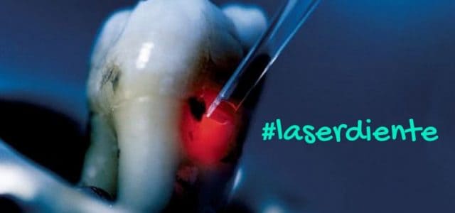 laser diente laser diente