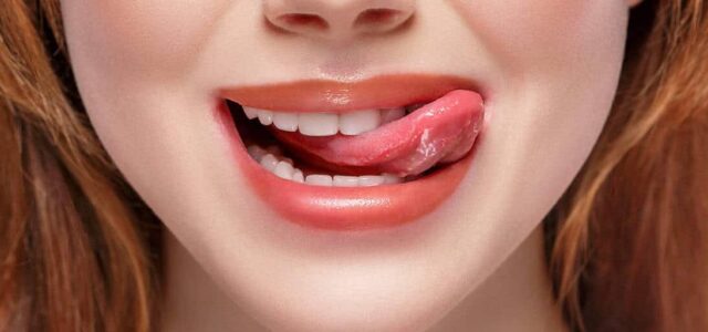 Qué es la lengua agrietada Problemas de la lengua fisurada