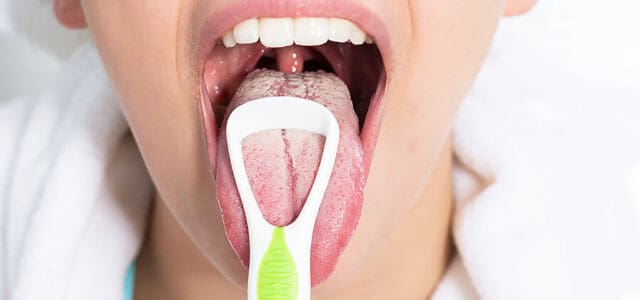 Cómo limpiar la lengua blanca
