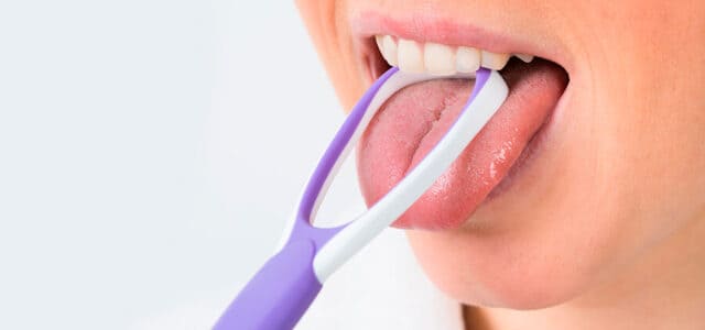 Limpieza de la lengua rajada