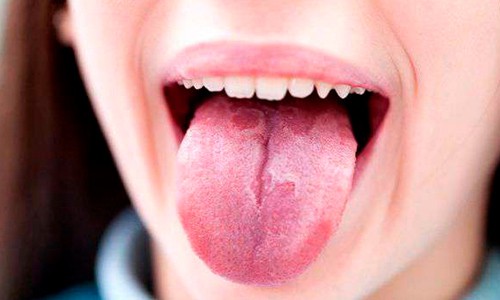pequena molestia en la lengua