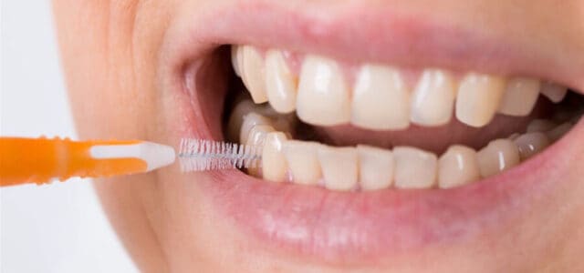Cepillo interdental