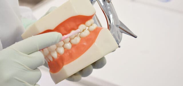 Precio llimpieza dental rpofunda