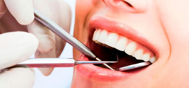 Higiene bucal con implante dental