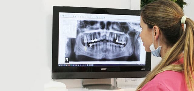 Radiografía dental