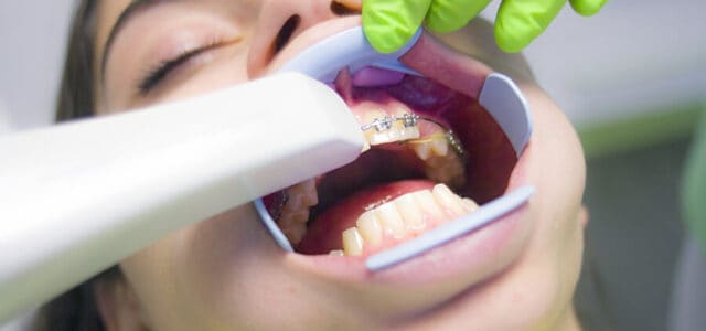 Ortodoncia halitosis