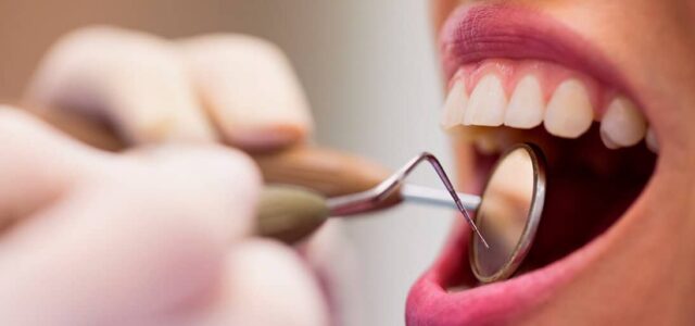 Fase de mantenimiento periodontal Mantenimiento periodontal