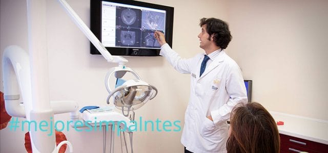 mejores implantes del mercado mejores implantes dentales del mercado