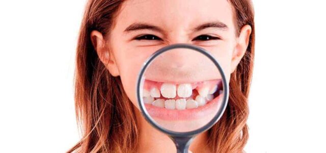 Microdoncia y macrodoncia Desarrollo dentario